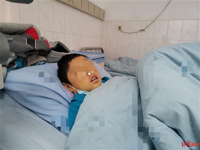 攀枝花12岁男孩患罕见怪病：怕晒太阳 发病时嘴眼出血